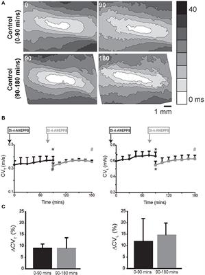 TNFα Modulates Cardiac Conduction by Altering Electrical Coupling between Myocytes